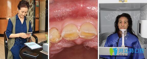 術(shù)前牙齒檢查