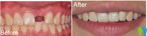洛陽澗西維樂口腔案例 洛陽澗西維樂口腔案例