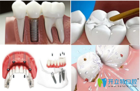 洛陽維樂口腔門診部宣傳圖 洛陽維樂口腔門診部宣傳圖