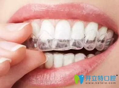 舟山健寧隱形牙齒矯正器