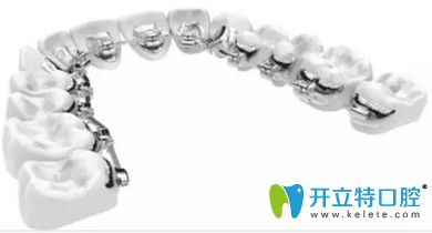 舟山健寧自鎖牙齒矯正器
