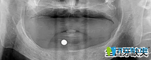 鎮(zhèn)江拜博口腔為郭先生拍攝的口腔全景圖