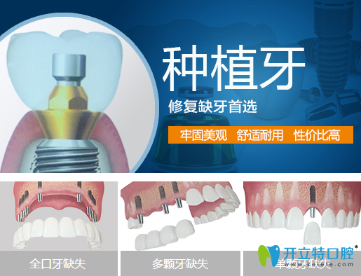 牙齒缺失說話漏風？德陽新橋口腔種植牙幫你改善缺牙問題
