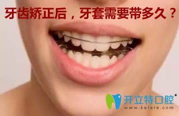 做完牙齒矯正后，保持器需要戴多長(zhǎng)時(shí)間？看完你就明白了
