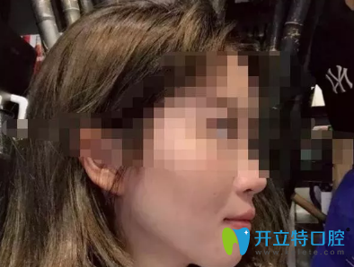 沒想到效果真的很好，我很感謝西安諾貝爾