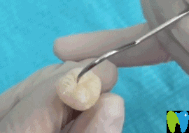 用尖銳的探針進行全面檢查