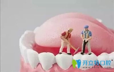 種植牙的壽命維持更長時間的小竅門