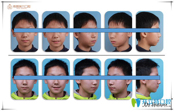 擁擠，單純排齊