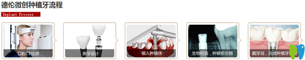 瑞爾口腔種植牙的簡單流程圖