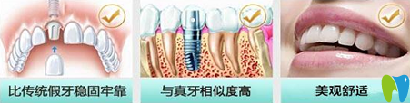 長沙雅美口腔門診種植牙優(yōu)點介紹圖