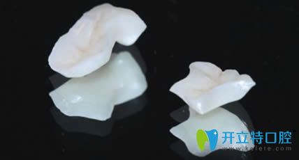DSD微笑美學修復所使用的材料