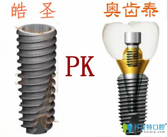 美國皓圣和韓國奧齒泰哪個種植體好？價格及使用壽命大PK