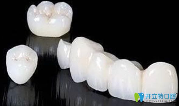 門牙有縫隙建議戴烤瓷牙