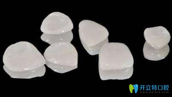 牙貼面是專門修復(fù)牙縫大的方法