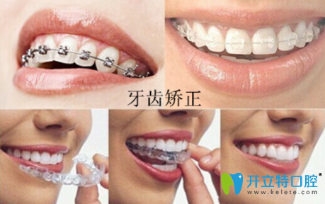 周佩佩科普：“牙齒矯正的年齡是什么時候？”