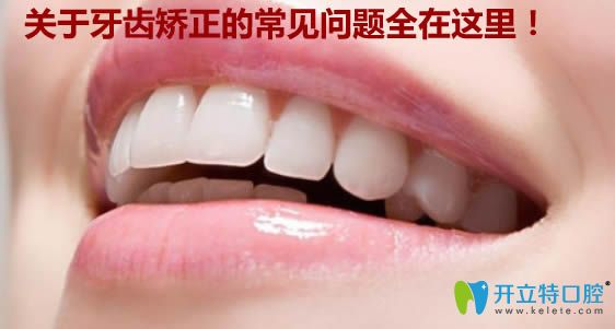 關(guān)于小孩牙齒矯正的年齡及其它常見問題的解答都在這