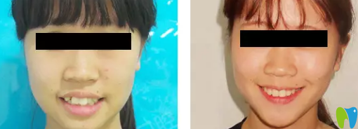 美樂(lè)口腔正畸<span style=