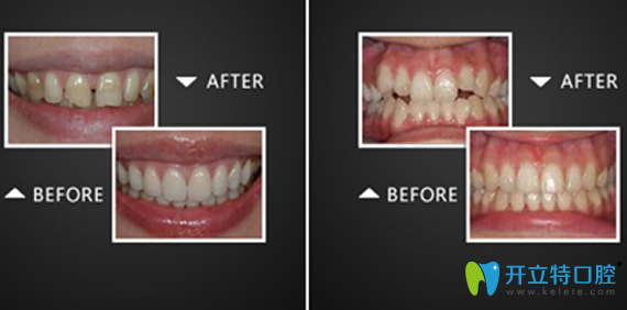 淮安口腔哪家好？看完牙知道口腔牙齒美容案例就知道