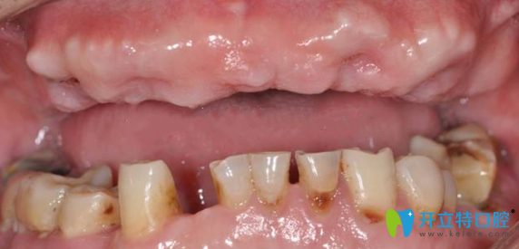 南京金臺(tái)口腔手術(shù)前