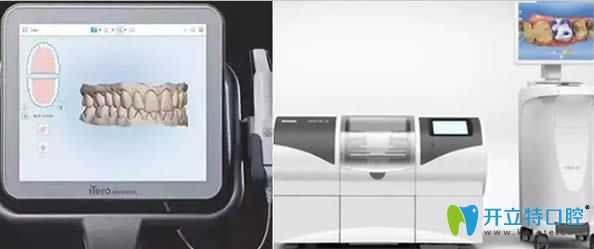iTero口內(nèi)掃描儀優(yōu)勢(shì)介紹 iTero口內(nèi)掃描儀優(yōu)勢(shì)介紹