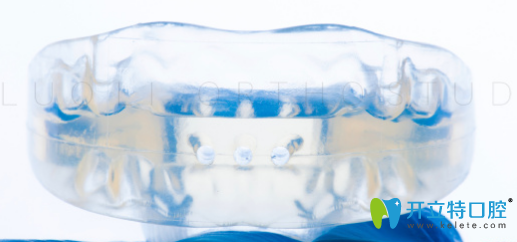 用過羅慕矯正的來點(diǎn)評(píng):羅慕矯正器到底好不好,多少錢一套呢