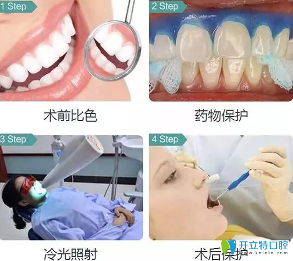 冷光美白牙齒的原理和步驟