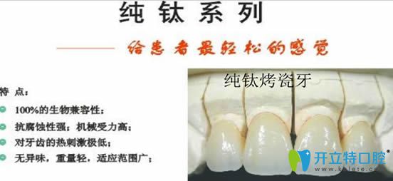 gh0097.com純鈦烤瓷牙圖片