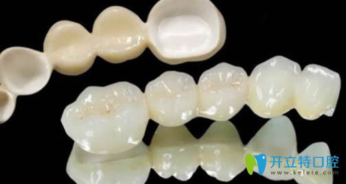 蘇文泰解析活動假牙的種類及價格