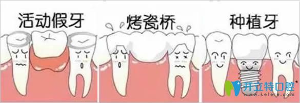 青島天皓口腔門診牙齒修復(fù)方式圖