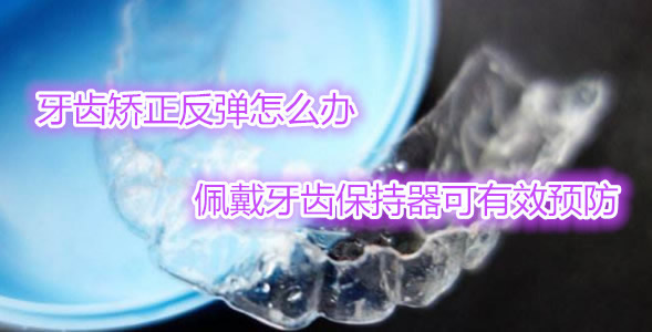 牙齒矯正一定要佩戴牙齒保持器嗎