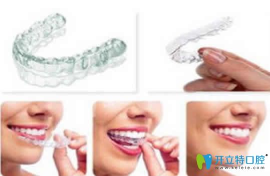 隱形正畸一般多少錢，與傳統(tǒng)正畸有什么區(qū)別