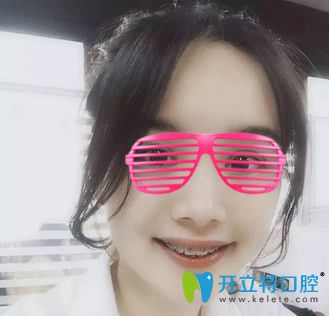 華爾康口腔帶牙套1~12月的變化圖 華爾康口腔帶牙套1~12月的變化圖