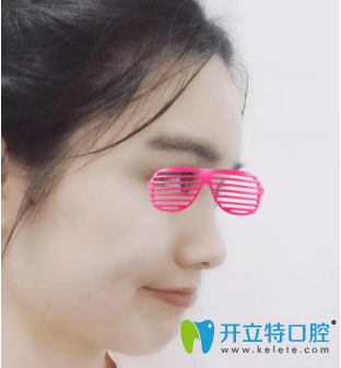 矯正牙齒12個(gè)月<span style= 矯正牙齒12個(gè)月<span style=