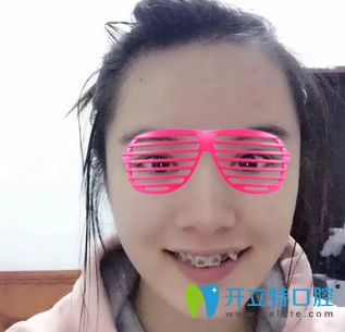 <!--<i data=20240703-sp></i>-->華爾康口腔矯正虎牙前 <!--<i data=20240703-sp></i>-->華爾康口腔矯正虎牙前