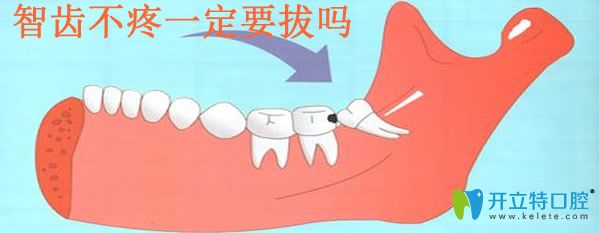 全面了解拔智齒的危害并分享智齒不疼一定要拔嗎？