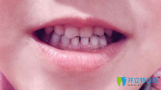 20181016372278.png image.png