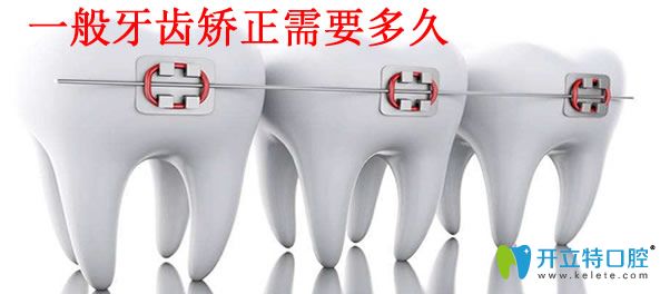 探訪重慶牙齒整形多少錢(qián) 牙齒矯正需要多長(zhǎng)時(shí)間恢復(fù)