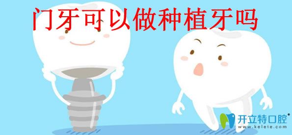 門牙缺失種植牙好不好 牙齒種植體品牌及價(jià)格的答案都在這