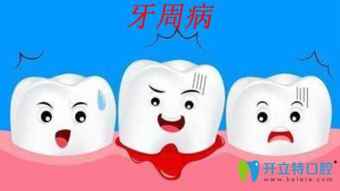 牙周病是什么？治療牙周病的方法和臨床效果分析