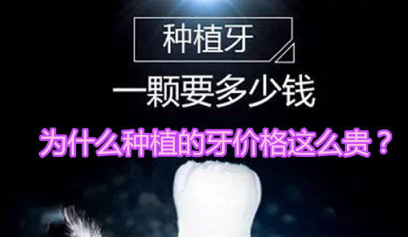 為什么種植的牙價格這么貴 種植體品牌和牙冠種類占大部分