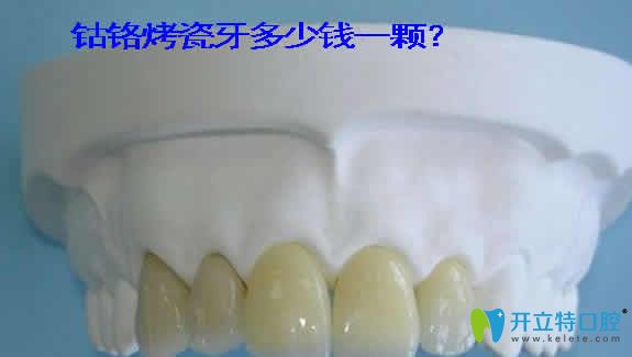鈷鉻烤瓷牙的價(jià)格