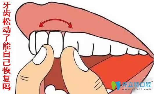 牙齒松動(dòng)了能不能自己恢復(fù)