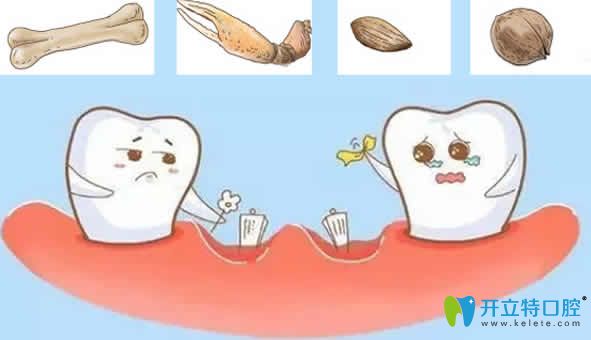 種植牙后能隨便咬硬物嗎