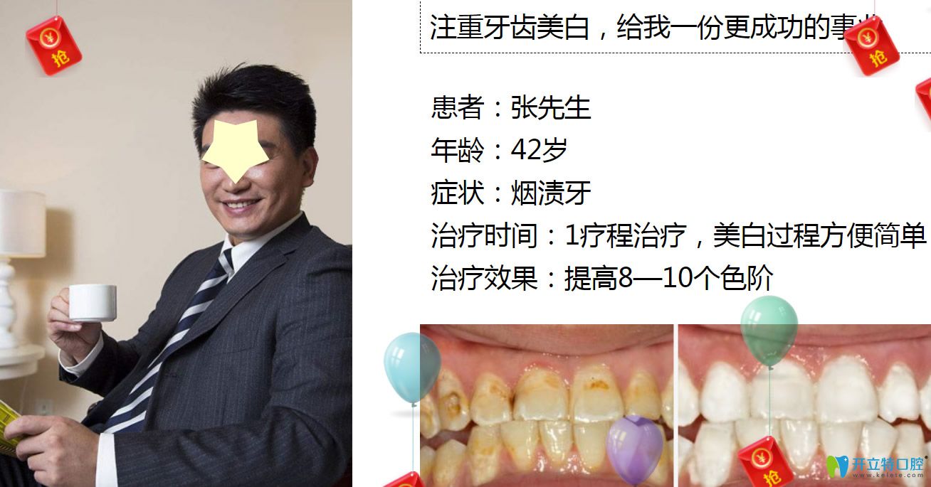 深圳牙齒美白哪里做？格倫菲爾口腔皓齒美白案例公布