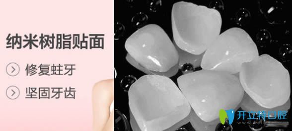 什么是樹脂貼面