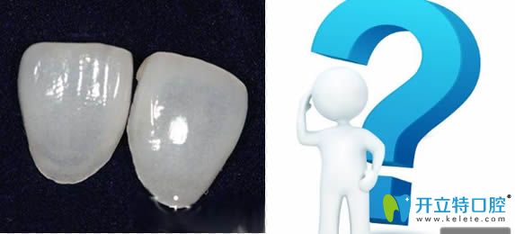 樹脂貼面多少錢一顆