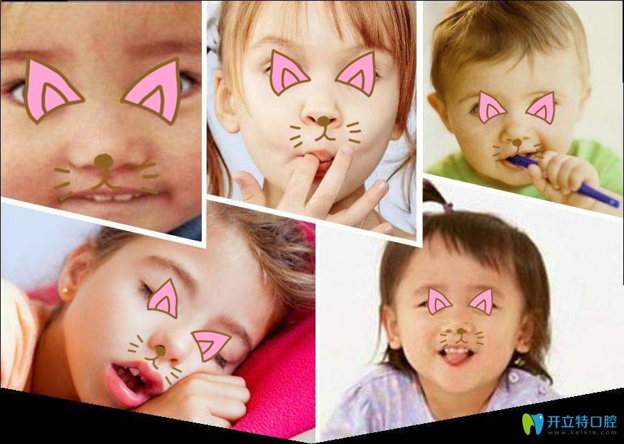 孩子有些不良的習慣可能影響牙頜的發(fā)育