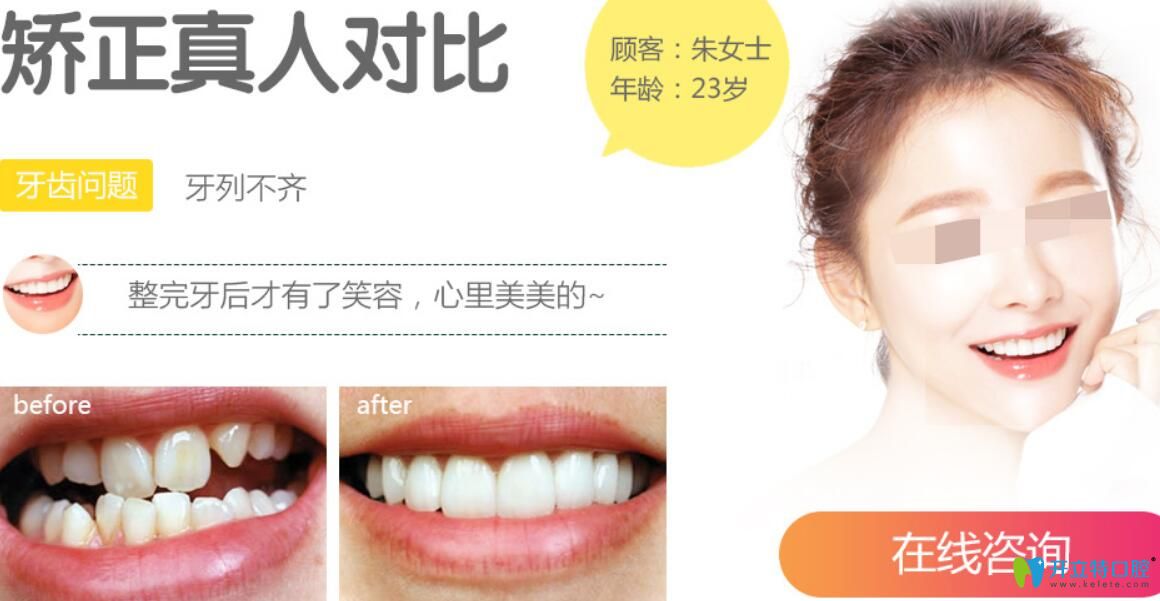 聊城口腔醫(yī)院怎么樣呢？真人牙齒矯正案例效果給你帶來驚喜