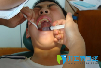 治牙打麻藥注意事項(xiàng)