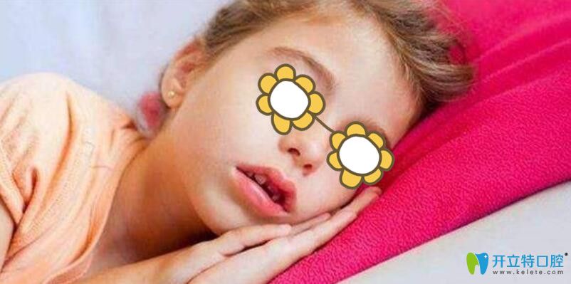 睡眠時張口呼吸